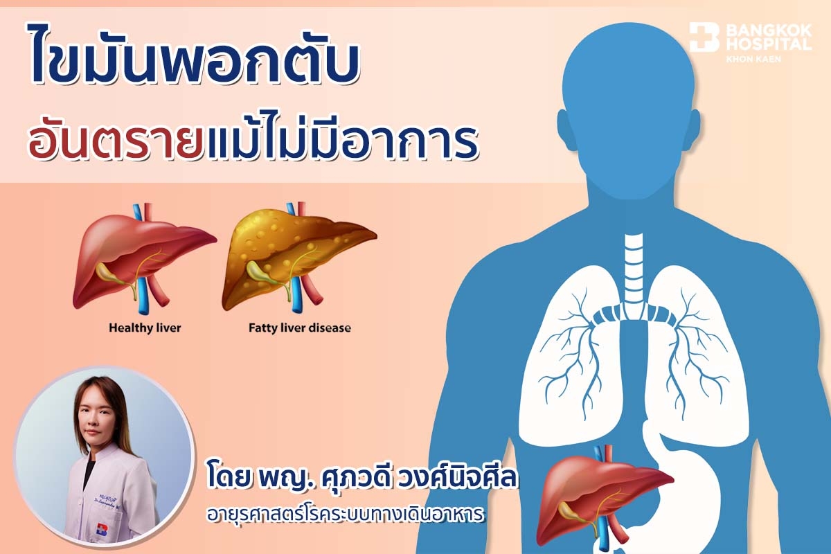ไขมันพอกตับ
