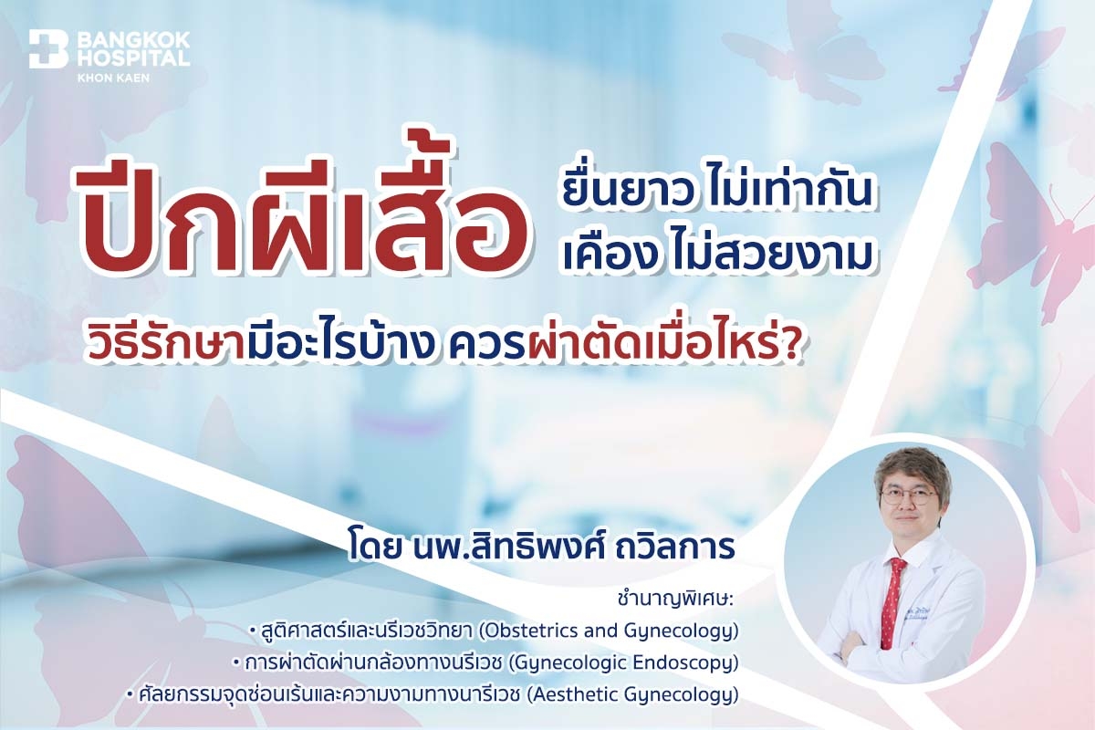 ปีกผีเสื้อ